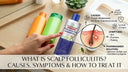 What Is Scalp Folliculitis? Causes, Symptoms & How to Treat It