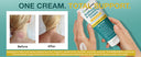 Antifungal Cream for Jock Itch, Ringworm, Psoriasis & Athlete’s Foot