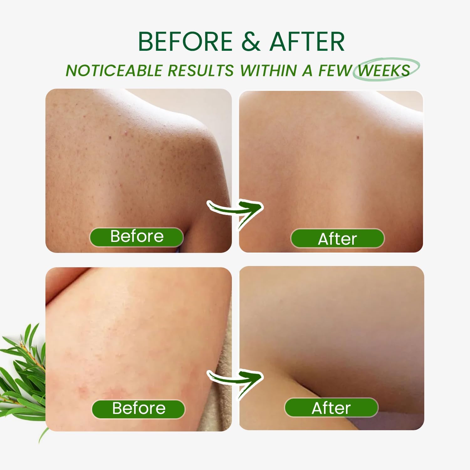 PHARMBANNER Tea Tree Antifungal Body Wash