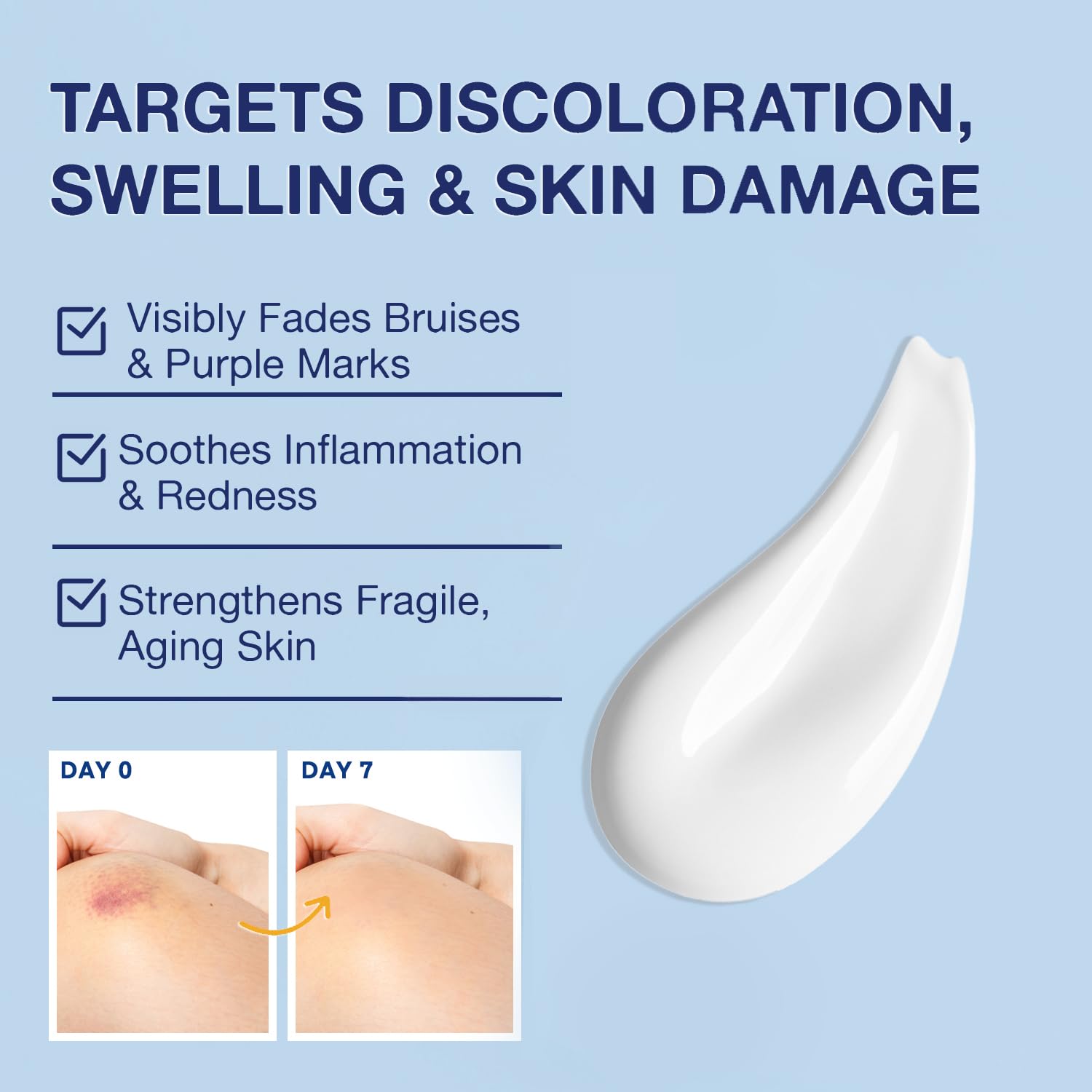 PHARMBANNER Arnica Bruise Cream