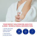 Antifungal Cream for Jock Itch