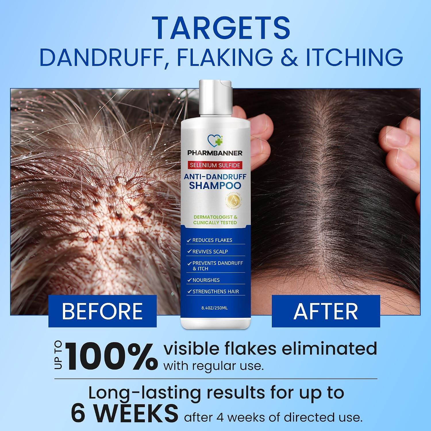 PHARMBANNER Scalp Care Shampoo
