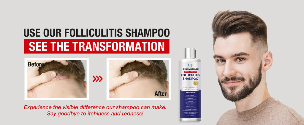PHARMBANNER Anti-Fungal Shampoo - 2 Pack